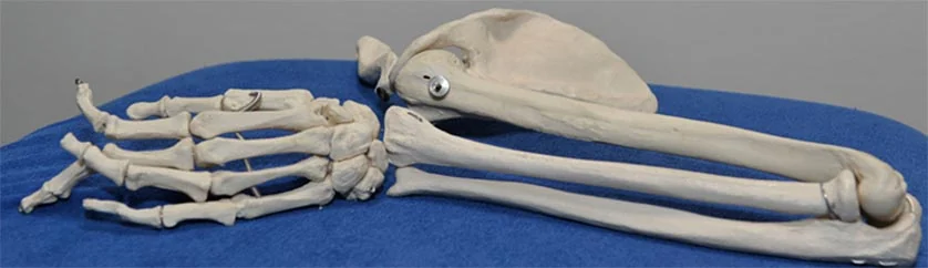 Skeletmodel van een hand en onderarm op een blauwe behandeltafel